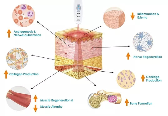  Photobiomodulatory effects of superpulsed 904 nm laser therapy on bioenergetics status in burn wound healing